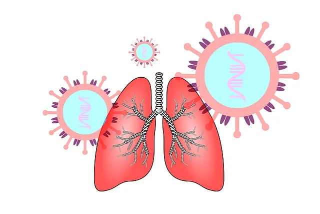 Histoplasmosis