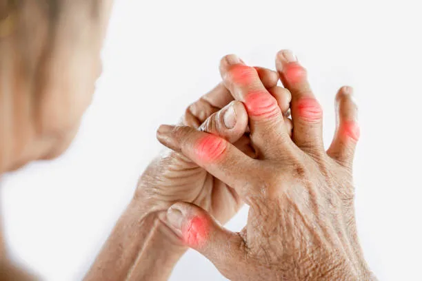 what is Arthritis: Causes, Symptoms, Care, Medication, Diet, Family and Friends' Cooperation, Treatment, and Support,9points